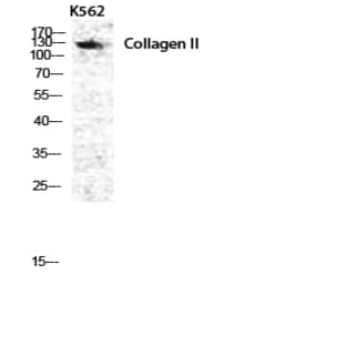 COL2A1 Polyclonal Antibody avatar