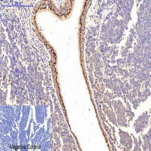 Collagen I Mouse Monoclonal Antibody(4H10) avatar