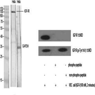 IGF-IR Polyclonal Antibody avatar