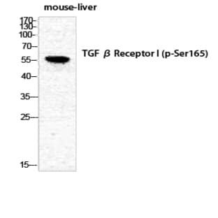 TGF? RI (phospho Ser165) Polyclonal Antibody avatar