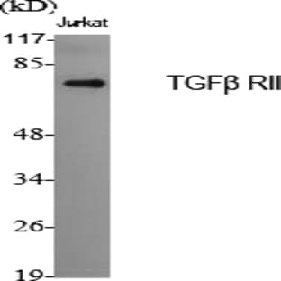 TGF? RII Polyclonal Antibody avatar