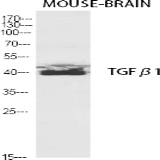 TGF?1 Polyclonal Antibody avatar