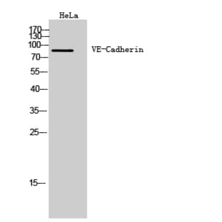 VE-Cadherin Polyclonal Antibody avatar