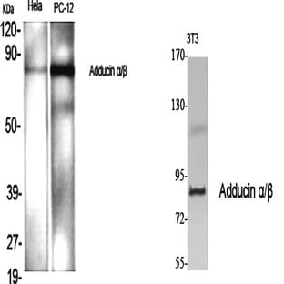 Adducin ?/? Polyclonal Antibody