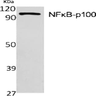 NF?B-p100 Polyclonal Antibody avatar