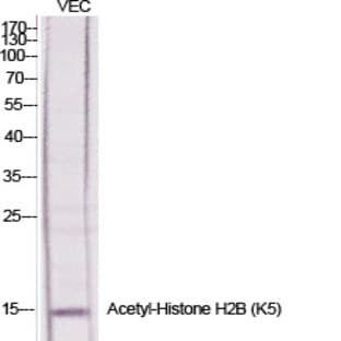 Histone H2B (Acetyl Lys5) Polyclonal Antibody avatar