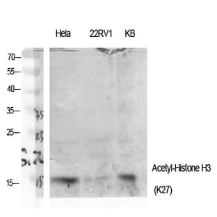 Histone H3 (Acetyl Lys27) Polyclonal Antibody avatar