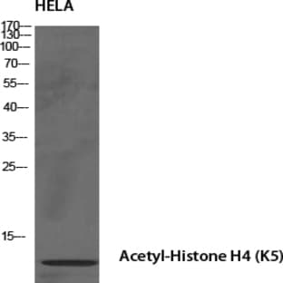 Histone H4 (Acetyl Lys5) Polyclonal Antibody avatar