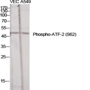ATF-2 (phospho Ser62) Polyclonal Antibody avatar