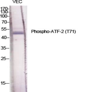 ATF-2 (phospho Thr71) Polyclonal Antibody avatar