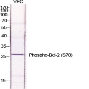 Bcl-2 (phospho Ser70) Polyclonal Antibody avatar
