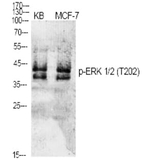 ERK 1/2 (phospho Thr202) Polyclonal Antibody avatar