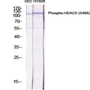 HDAC5 (phospho Ser498) Polyclonal Antibody avatar