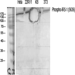 IRS-1 (phospho Ser636) Polyclonal Antibody avatar