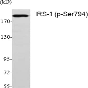IRS-1 (phospho Ser794) Polyclonal Antibody avatar