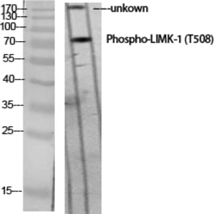 LIMK-1 (phospho Thr508) Polyclonal Antibody avatar