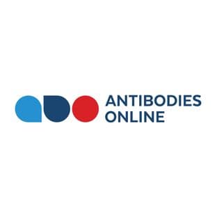Rac GTPase Activating Protein 1 (RACGAP1) ELISA Kit avatar
