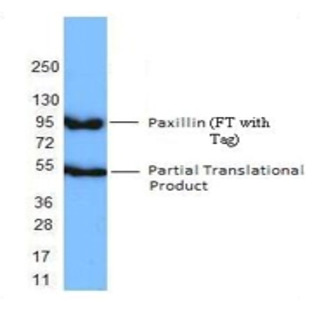 Recombinant Human Paxillin 