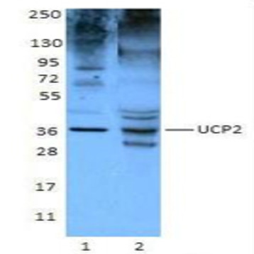 Purified anti-UCP2