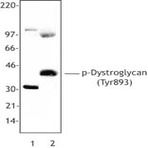 Purified anti-Dystroglycan Phospho (Tyr893)