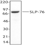 Purified anti-SLP-76