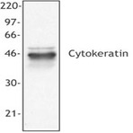 Purified anti-Cytokeratin (pan reactive)