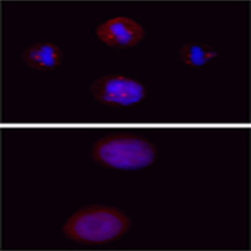 Purified anti-CAK (cdk7) Phospho (Ser164/Thr170)