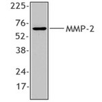 Purified anti-MMP2