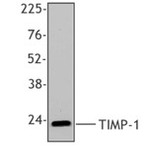 Purified anti-TIMP-1