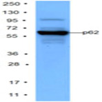 Purified anti-P62