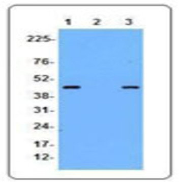 Purified anti-Ficolin B