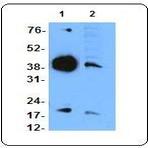 Purified anti-tartrate-resistant acid phosphatase (TRAcP)