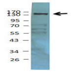 Purified anti-HDAC6