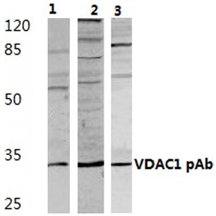 VDAC1