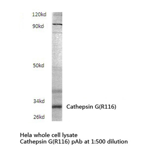 Cathepsin