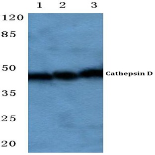 Cathepsin