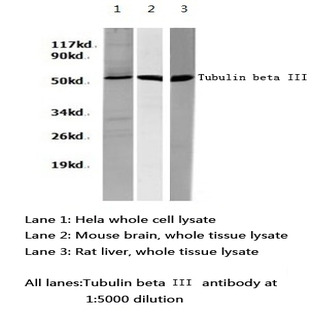 Tubulin beta III pAb