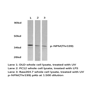 p-NPM (T199) pAb