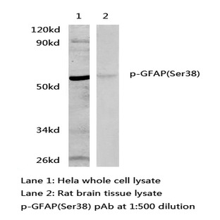 p-GFAP(Ser38) pAb