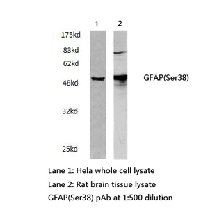 GFAP (Ser38) pAb