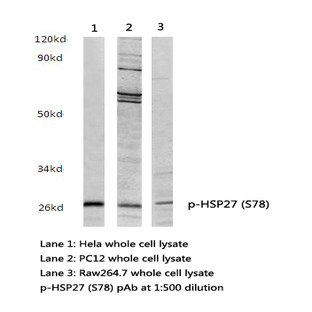 p-HSP27 (S78) pAb