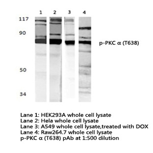 p-PKC (alpha) (T638) pAb