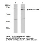 p-Raf-B (T599) pAb