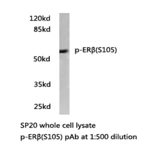 p-ER(beta) (S105) pAb