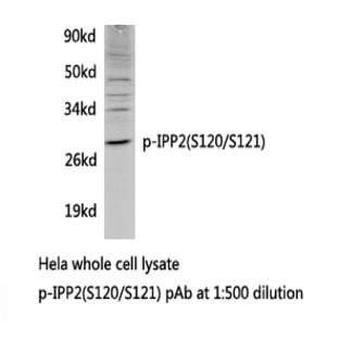 p-IPP2 (S120/S121) pAb