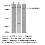 p-TERT(S824) pAb
