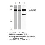 Stat3 (S727) pAb