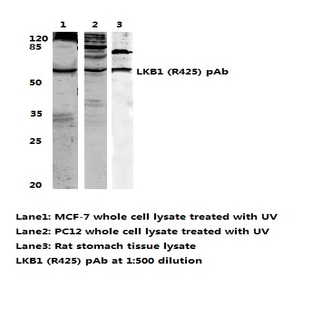 LKB1 (R425) pAb