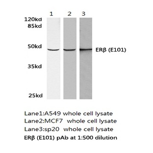 ER(beta) (E101) pAb