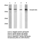 Smad2 (S2) pAb